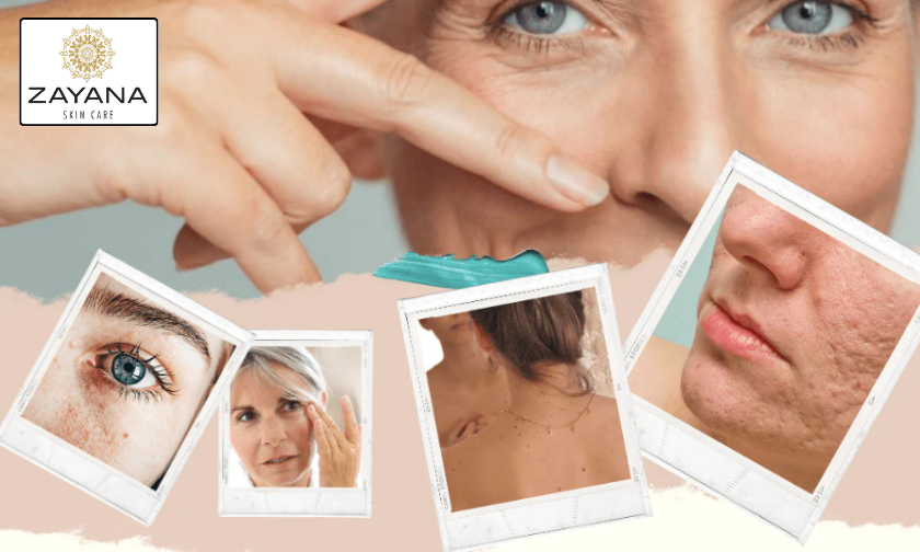 Why Shoppers Love Zayana Oil!