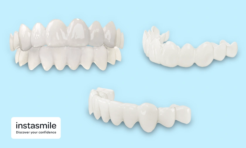 Instasmile UK Review: Best Cosmetic Clip-On Veneers! ([wpsm_custom_meta type=date field=month] [wpsm_custom_meta type=date field=year]) - The Complete Portal