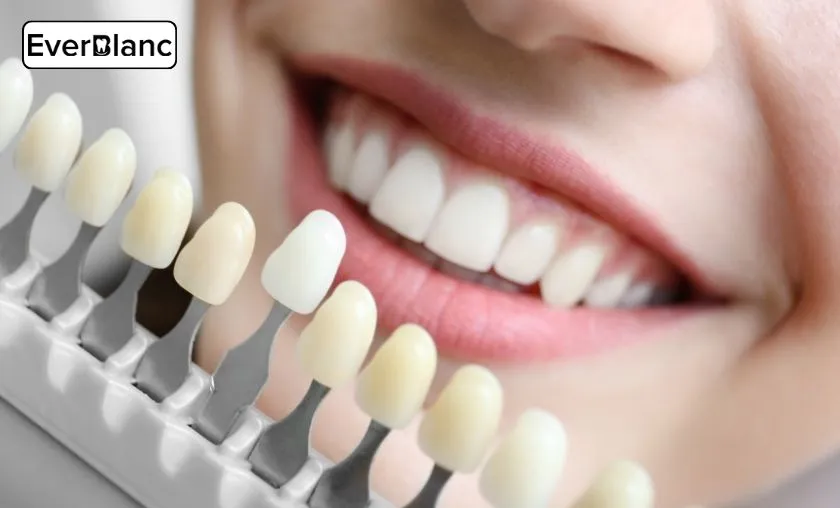 EverBlanc Review: The Best Teeth Whitening Strips! ([wpsm_custom_meta type=date field=month] [wpsm_custom_meta type=date field=year]) - The Complete Portal